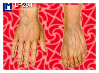 LP294: HAND AND FOOT - ANATOMICAL